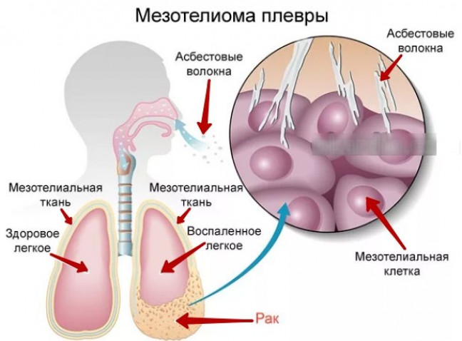 Вреден ли здоровью материал